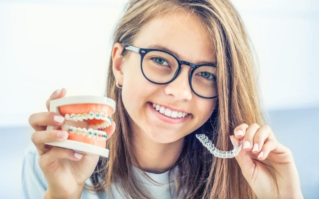 Invisalign or Braces: Which Should I Get?