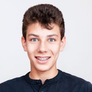 brister orthodontics pearl ms services clarity advanced ceramic braces image