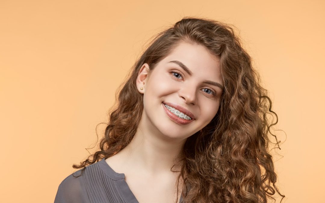 How Do You Take Care of Ceramic Braces?