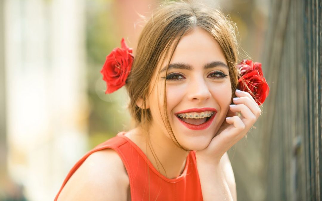 5 Things to Love About Braces