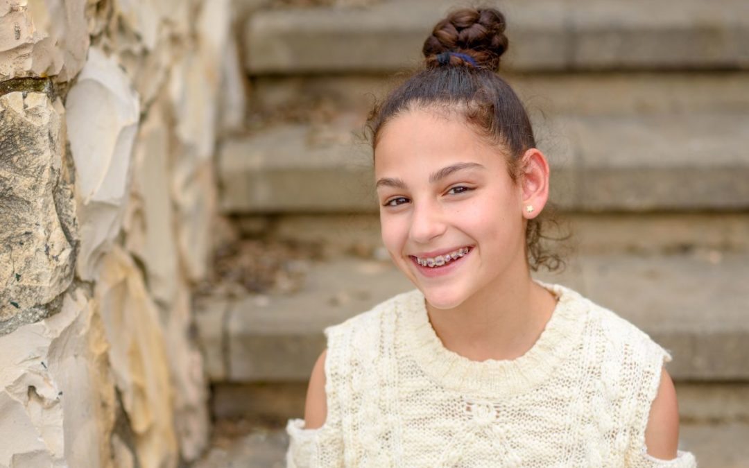 5 Reasons Why Braces are Awesome
