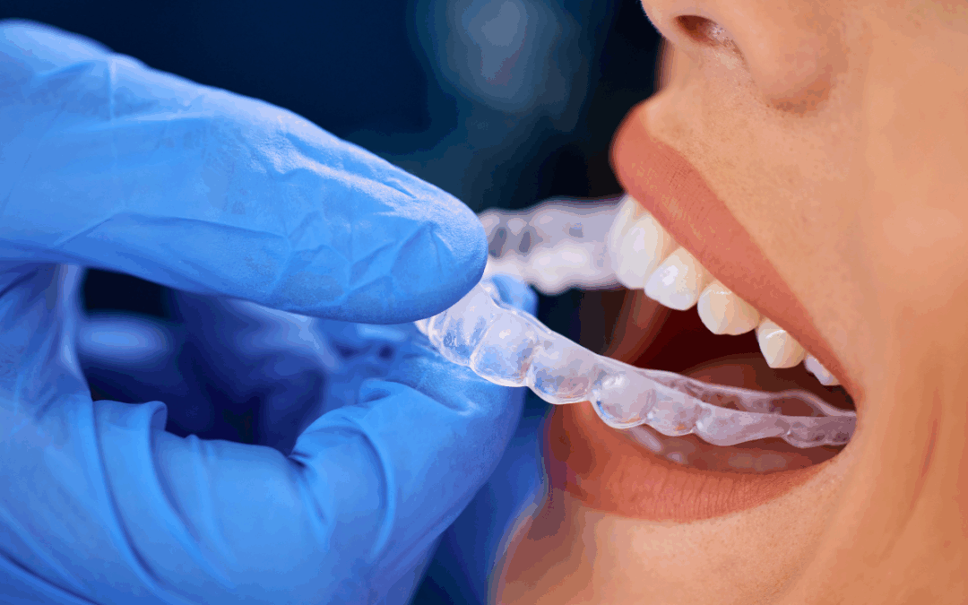 Understanding Why Invisalign Results Can Vary: Key Factors Affecting Treatment Outcomes