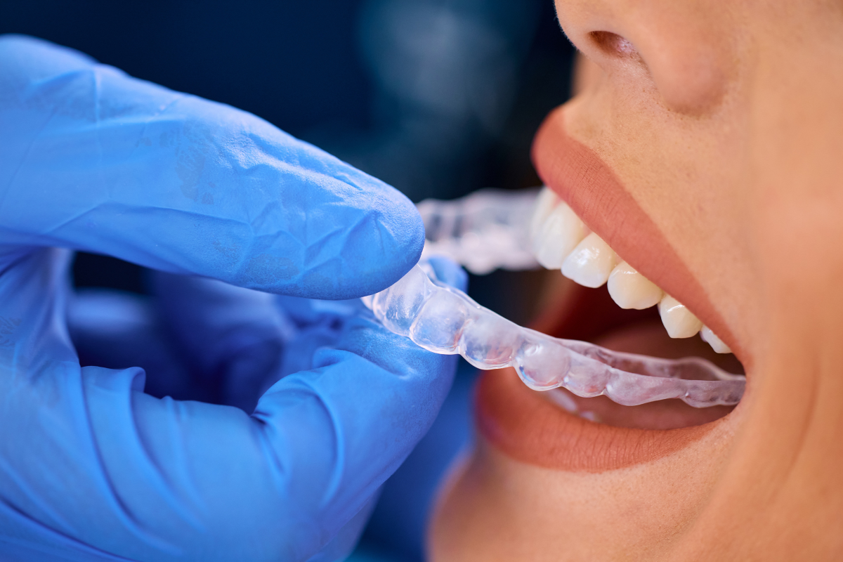 Invisalign treatment in Pearl