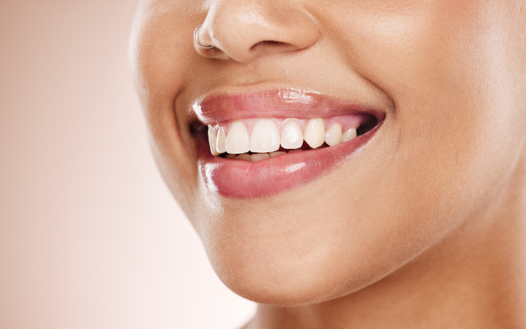 Cosmetic Restoration : How Smile Makeovers Can Transform More Than Just Your Teeth