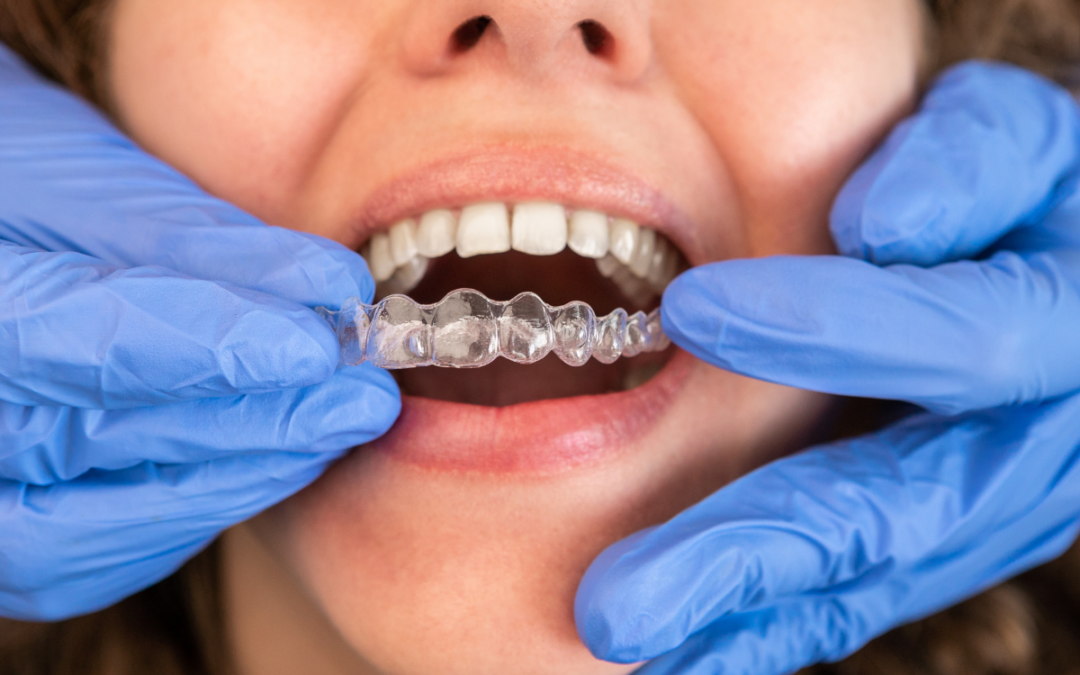 How to Clean and Care for Your Clear Aligners