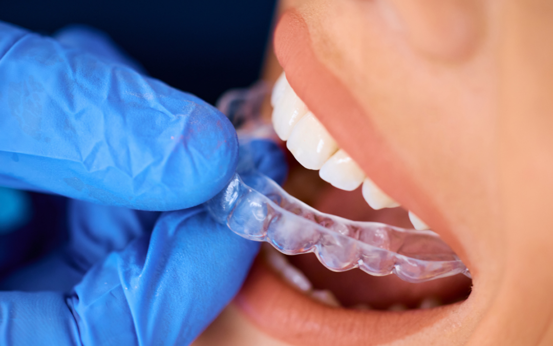 Back-to-School Confidence: Why So Many Pearl Teens Are Choosing Invisalign This Year