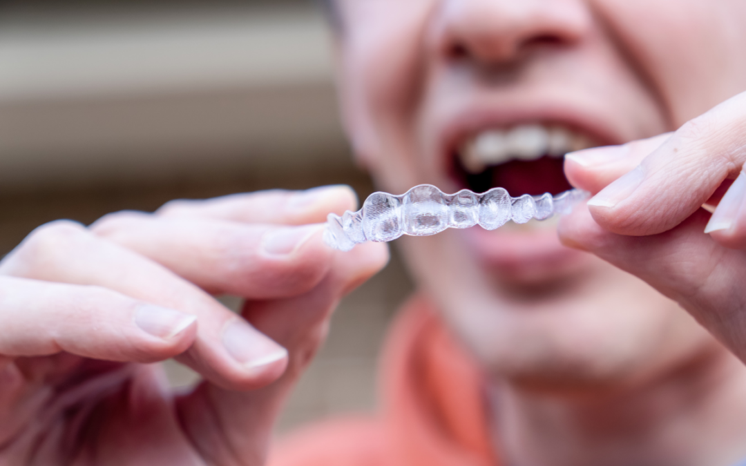 Invisalign and Gum Disease: Can the Two Go Together?