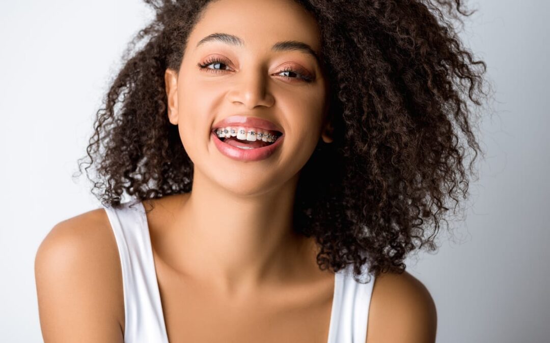 What to Eat and Expect After Your Orthodontic Treatment Ends